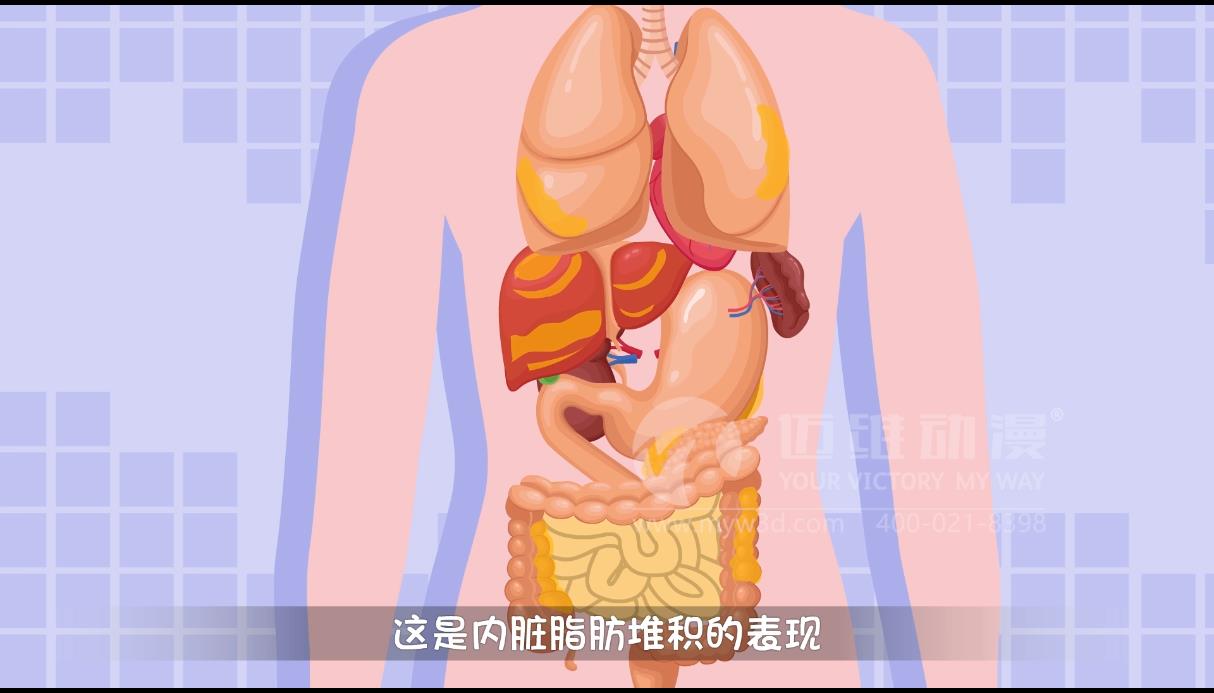 MG動畫，邁維動漫.jpg